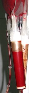 transfuzie sange donare sange bucuresti cum unde cand poti sa donezi sange bucuresti ilfov centre judetene, doneazasange.ro